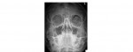 facial x-ray