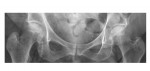 Pelvic x-ray magnified view