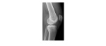 Lateral knee x-ray