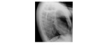 chest xray lateral view
