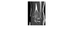 Coronal CT left ankle